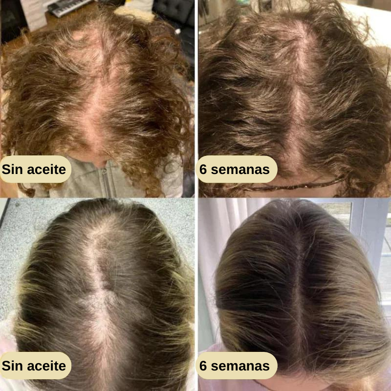 Serum natural para el crecimiento del cabello + guia para cuidado del cabello GRATIS