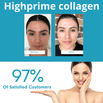 Set de   Mascarillas de colágeno soluble Skin Care Koreano