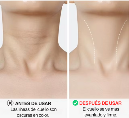 PARCHES REAFIRMANTES LEVANTA CUELLO INVISIBLE 15 UND