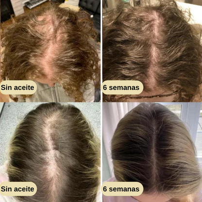 Serum natural para el crecimiento del cabello + guia para cuidado del cabello GRATIS