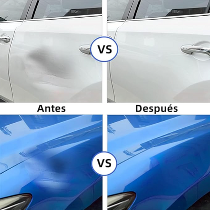 KIT DE REPARACIÓN DE ABOLLADURAS PARA COCHE