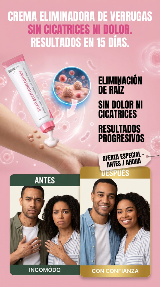 CREMA PARA REDUCIR Y ELIMINAR VERRUGAS SIN DEJAR CICATRICES