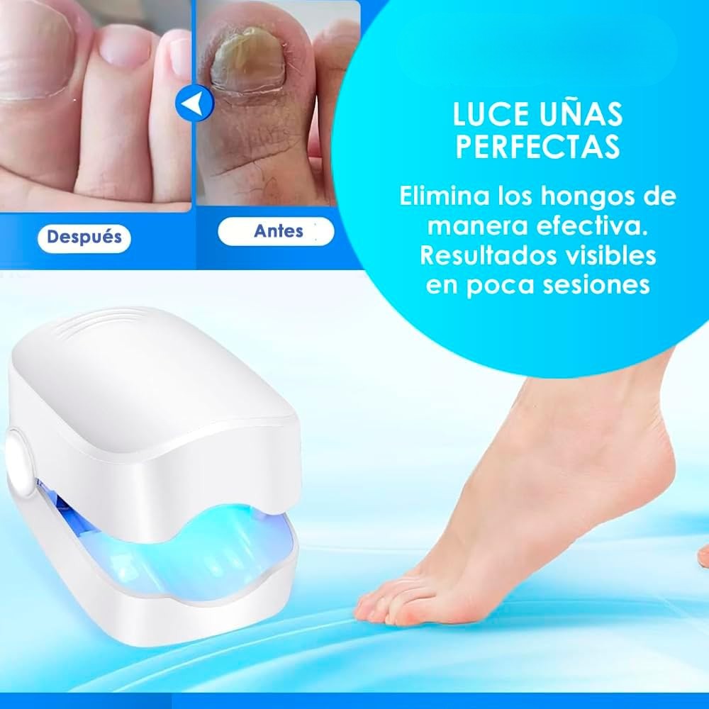 DISPOSITIVO LÁSER UV PARA TRATAMIENTO DE HONGOS EN UÑAS