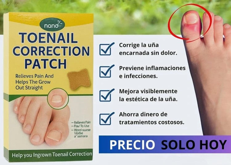 PARCHES PARA CORREGIR UÑAS ENCARNADAS - PACK 30 PCS