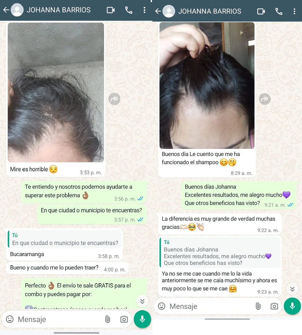 Serum anticaspa, control y anticaida