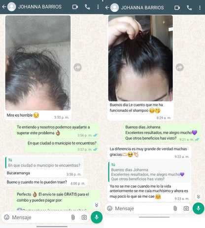 Serum anticaspa, control y anticaida